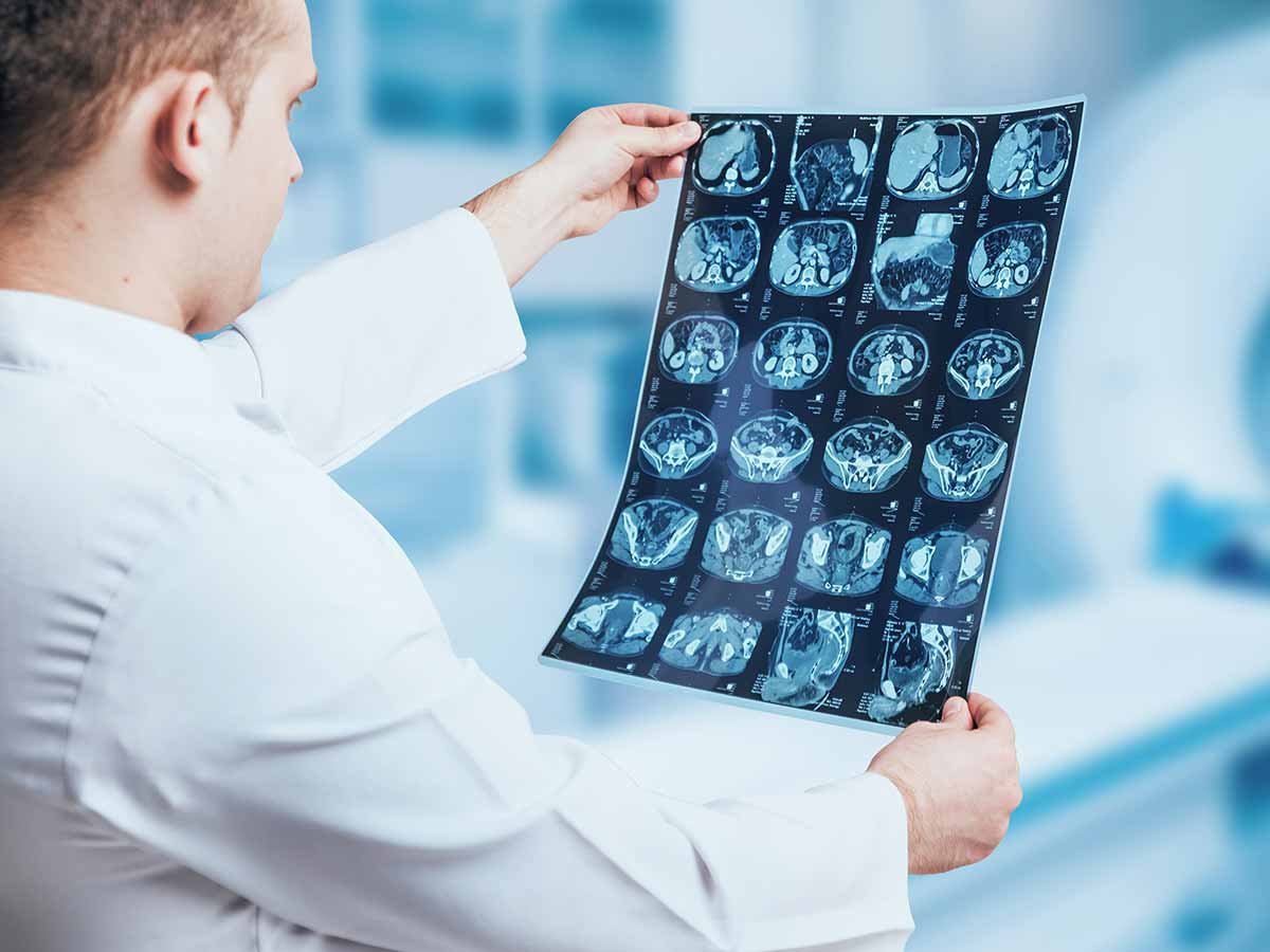 Long-Term Effects of a Traumatic Brain Injury