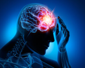 How Gross & Schuster Injury Lawyers Can Help After a Brain Injury in Mary Esther