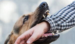 Why Choose Gross & Schuster Injury Lawyers to Handle Your Dog Bite Case in Navarre, FL?
