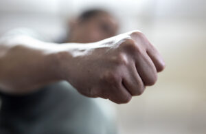 Why Choose Gross & Schuster Injury Lawyers After an Assault Injury in Pensacola, FL?